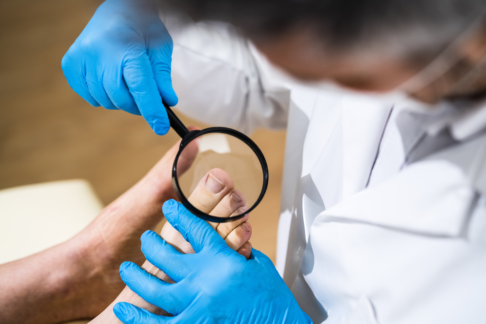 Ingrown Toenail Exam